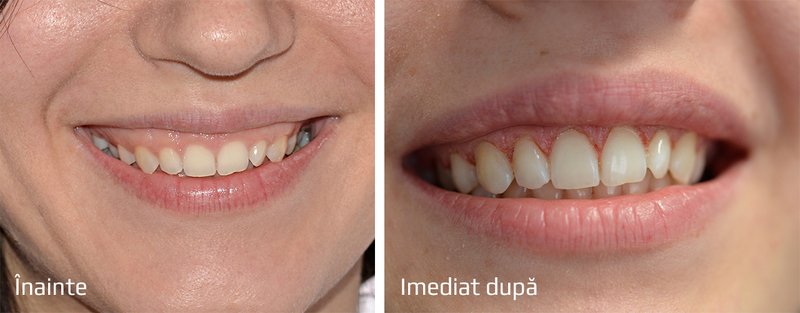 Advanced Gentle Dentist - clinica stomatologica
